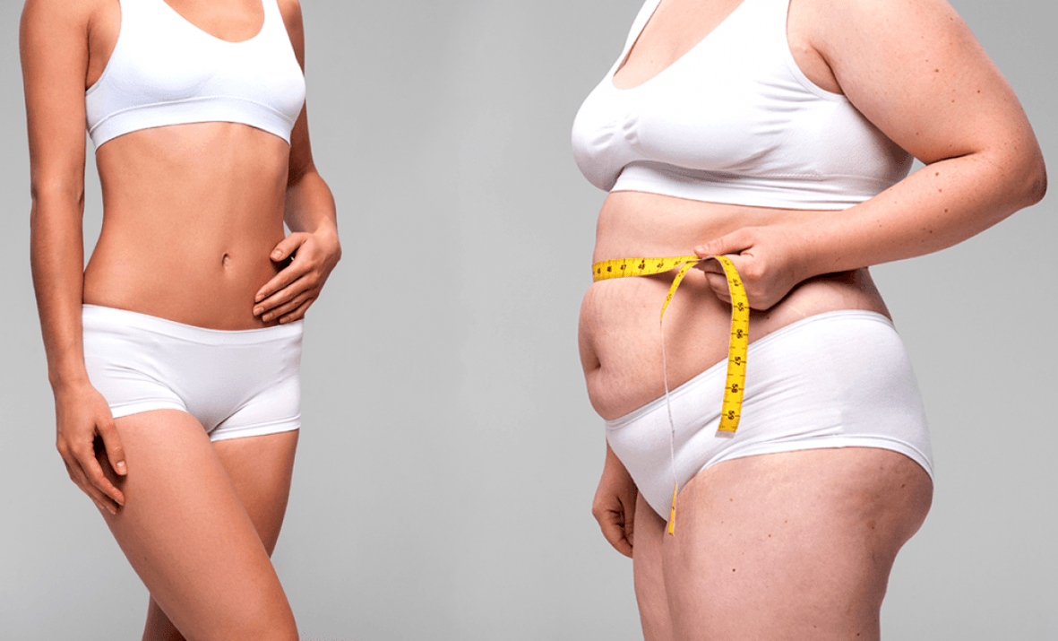 Keto dietos poveikis svorio metimui